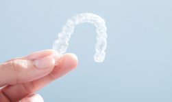 The Advantages Of Invisalign In Wagga For Teeth Straightening